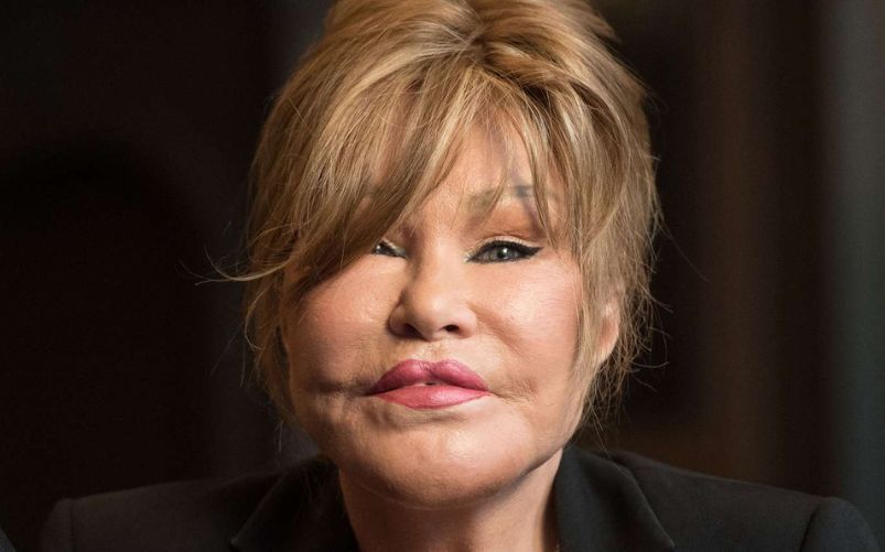 Jocelyn Wildenstein